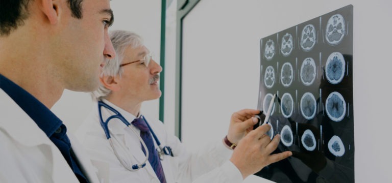 What Medications Can Harm Brain Health?