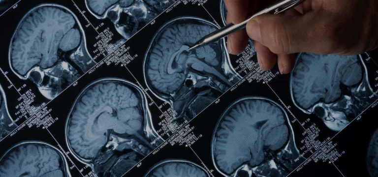 Why Am I Experiencing Memory Loss?