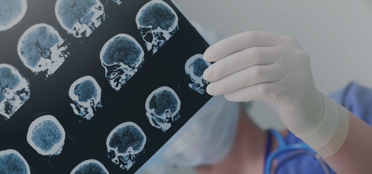 In the News: Bill Gates and the Dementia Discovery Fund